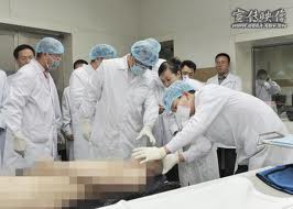 Ван Лицзюн, Китай, извлечение органов